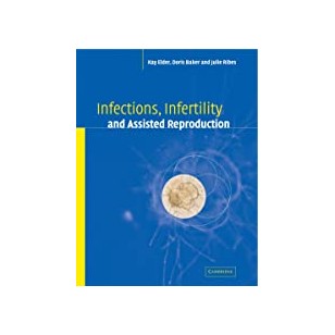 MYP Spanish Language Acquisition Phases 1 & 2 (for Years 1-3) (IB MYP Series)